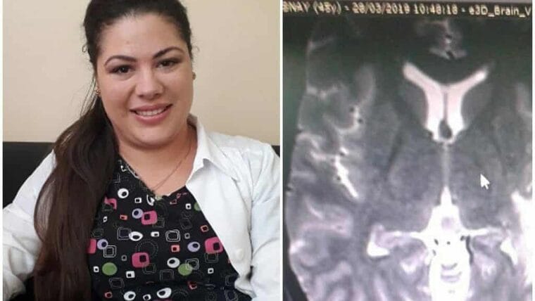 Cuba estrena método quirúrgico para eliminar tumor cerebral