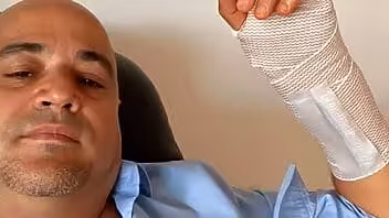 Actor cubano Andy Vázquez anunció que su tumor era benigno