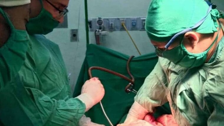 Extraen un tumor de más de 10 libras a un hombre en Isla de la Juventud