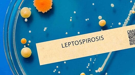 Aumento de leptospirosis en Cuba: ¡dos muertes en Guantánamo!