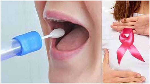 Gran Noticia: descubren nuevo test que detecta el cáncer de mama con saliva y en solo 5 segundos