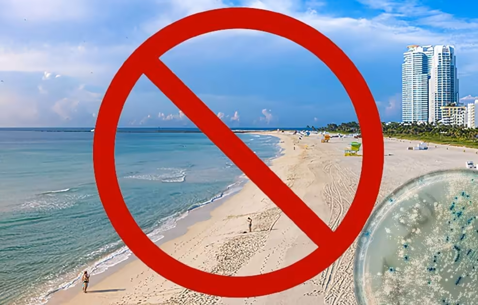 Emiten alerta en Miami-Dade por alta presencia de bacteria en dos playas