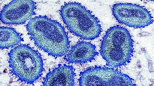 Nueva variante de la viruela del mono detectada en un viajero en Estados Unidos