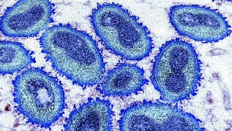 Nueva variante de la viruela del mono detectada en un viajero en Estados Unidos