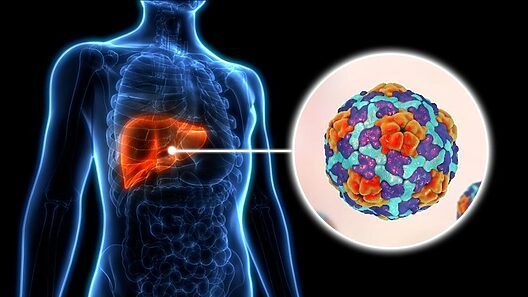 Confirman brote de hepatitis en Cuba