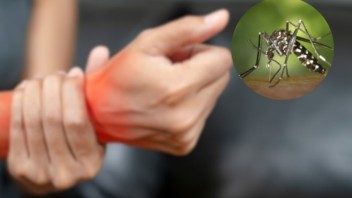 El chikungunya arrasa en Cuba: testimonios que revelan la verdadera crisis sanitaria  