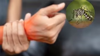 チクングニア熱がキューバを襲う：真の健康危機を明かす証言