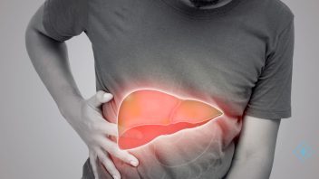 Matanzas en alerta por brotes de hepatitis