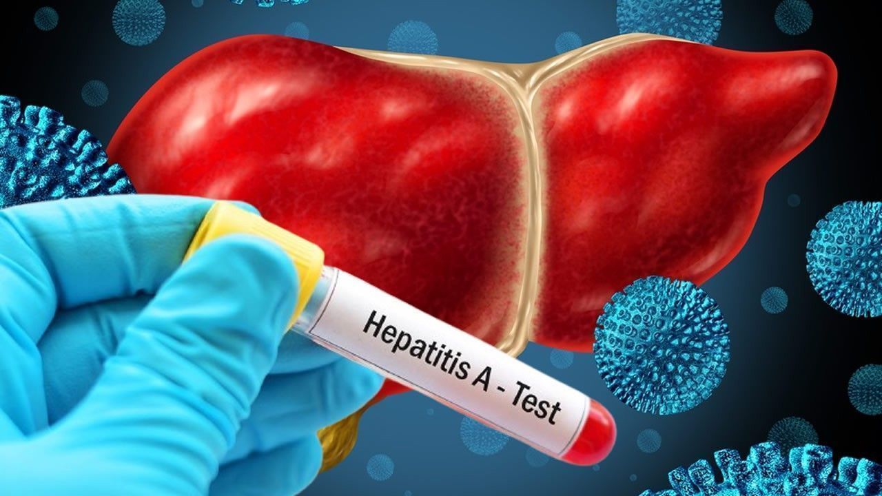 Aumentan los casos sospechosos de hepatitis A en Pinar del Río y San Luis