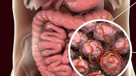 Brote de ciclosporiasis suma 46 casos en Florida: estos son los síntomas