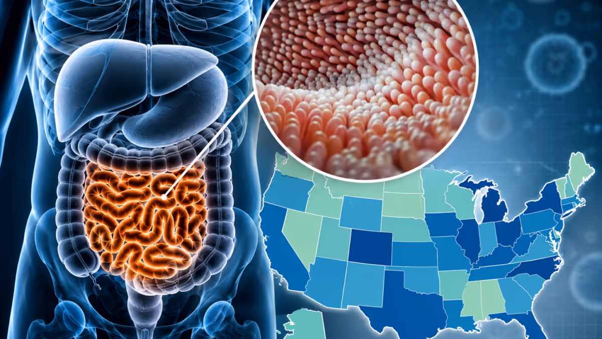 Brote de Cyclospora en Estados Unidos pone la lechuga bajo investigación