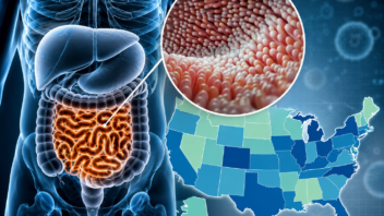 Brote de Cyclospora en Estados Unidos pone la lechuga bajo investigación