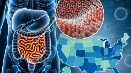 Brote de Cyclospora en Estados Unidos pone la lechuga bajo investigación