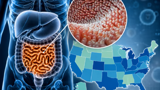 Brote de Cyclospora en Estados Unidos pone la lechuga bajo investigación