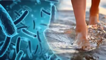 Bacteria carnívora en Florida deja 12 casos y una muerte en 2026
