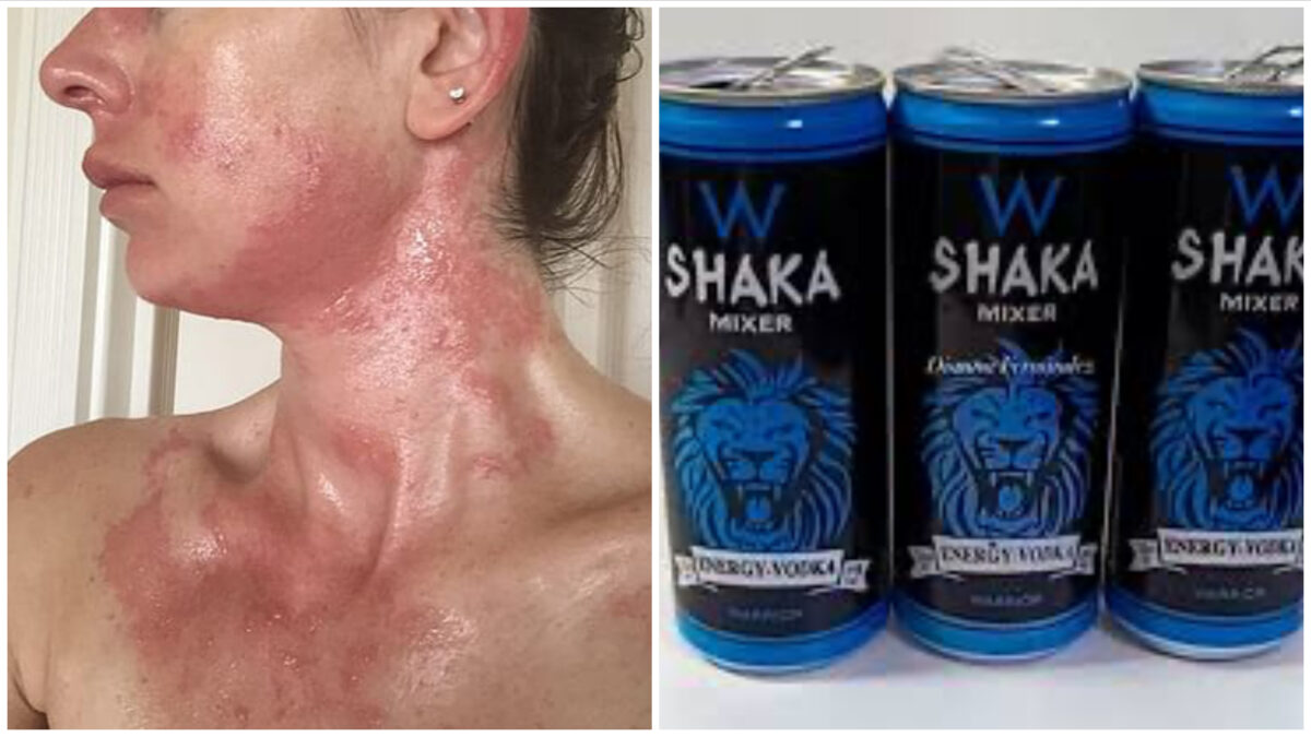 Intoxicación por Shaka afecta a cinco jóvenes en Sancti Spíritus
