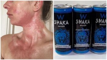 Intoxicación por Shaka afecta a cinco jóvenes en Sancti Spíritus