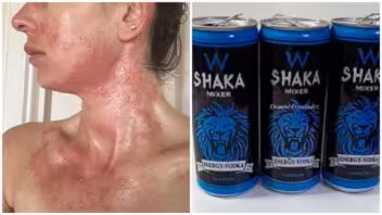 Intoxicación por Shaka afecta a cinco jóvenes en Sancti Spíritus