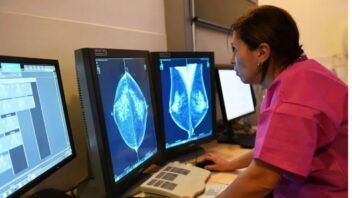 Aprueban nuevo tratamiento contra el cáncer de mama avanzado: lo retrasa 15 meses