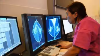 Aprueban nuevo tratamiento contra el cáncer de mama avanzado: lo retrasa 15 meses